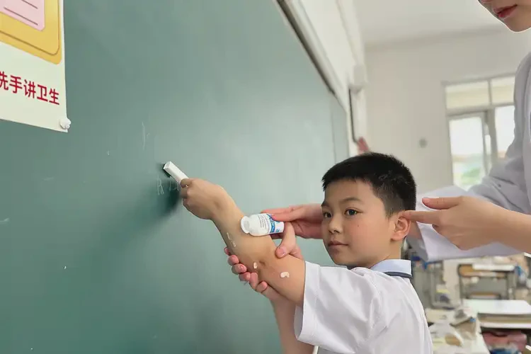 小學(xué)生手臂容易長濕疹可不可以根治(圖3)