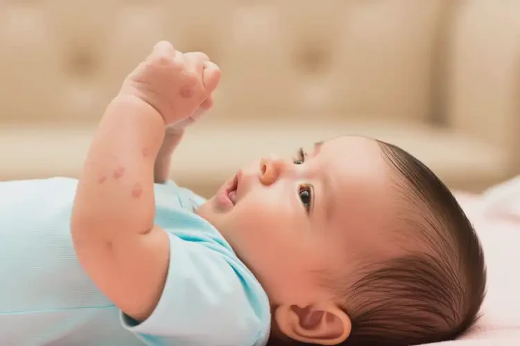 孩子手臂偶爾長濕疹可以治好嗎(圖2)