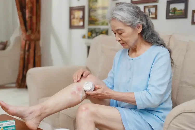 老年人大腿容易起湿疹可不可以根治(图2)