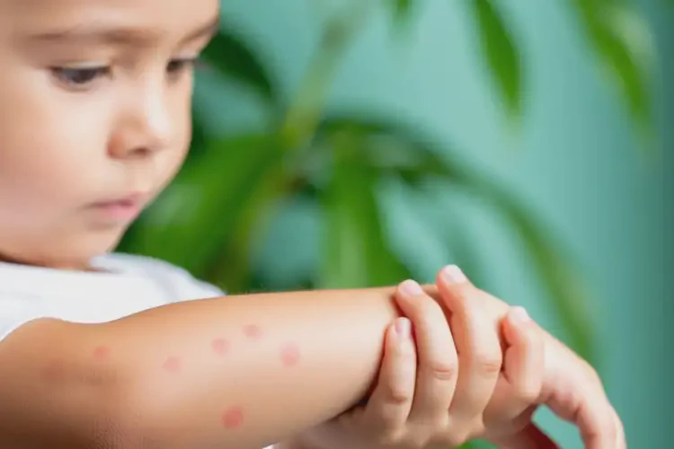 孩子手臂上偶爾起濕疹可以治好嗎(圖2)