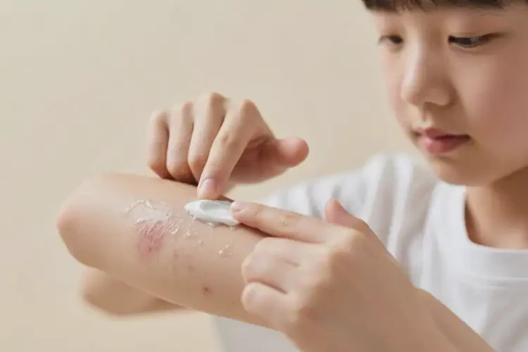 青少年手臂上容易長濕疹可不可以根治(圖4)