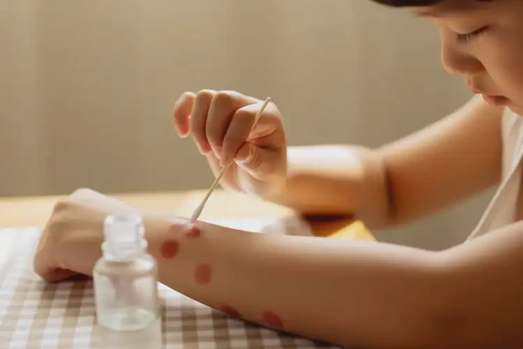 兒童手臂出現(xiàn)濕疹可不可以根治(圖4)