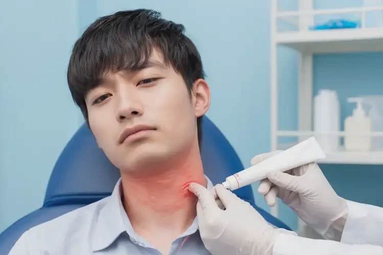 男生脖子起濕疹不管它會自己痊愈嗎(圖3)