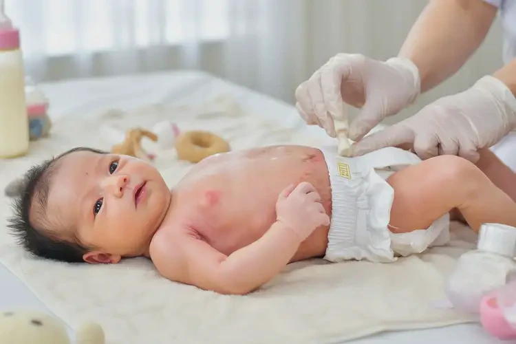 新生兒肚子長(zhǎng)濕疹不管它會(huì)自己痊愈嗎(圖3)