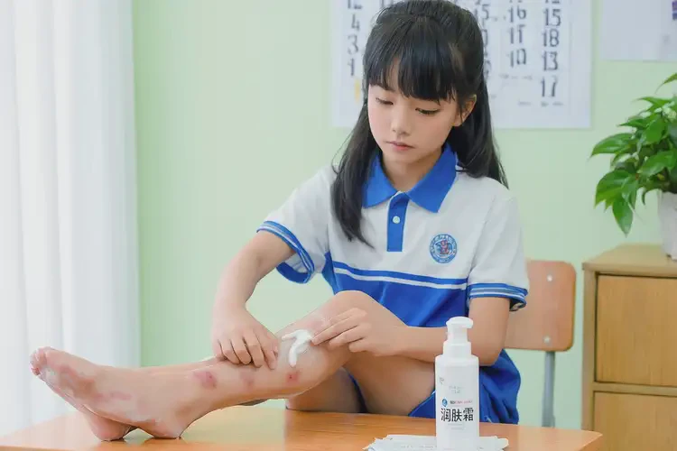 中學(xué)生小腿上容易起濕疹可不可以根治(圖2)