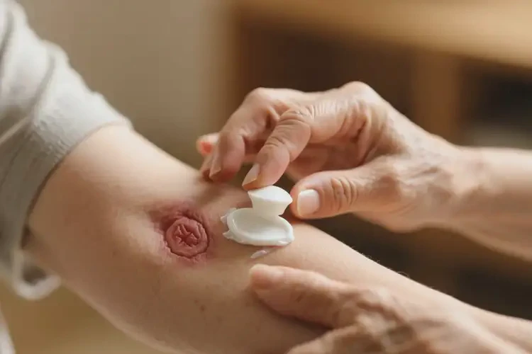 老年人手臂起濕疹可以治好嗎(圖3)