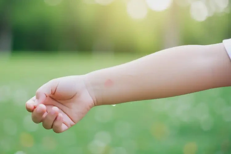 小孩手臂上容易長濕疹可以治好嗎(圖4)