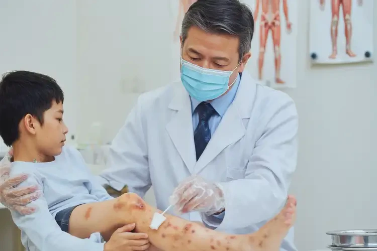 孩子小腿長濕疹可不可以根治(圖3)