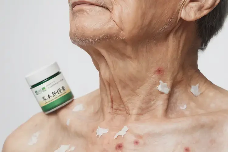 老年人脖子上偶爾起濕疹可不可以根治(圖1)