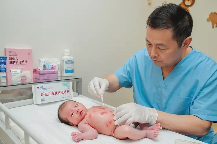 新生兒脖子經(jīng)常長濕疹可不可以根治(圖3)