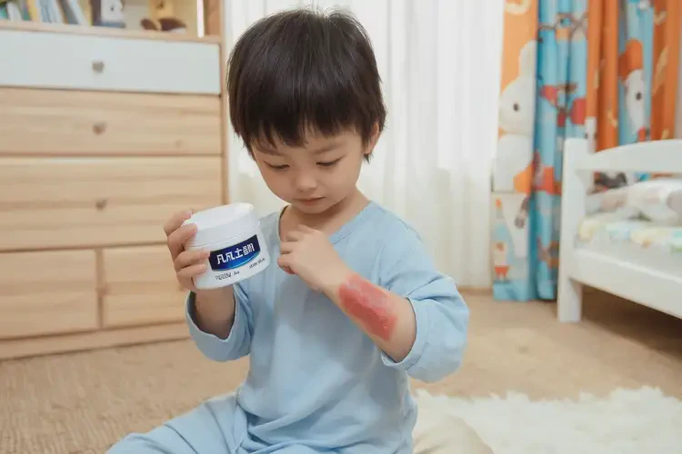 孩子腳上起濕疹可以治好嗎(圖1)