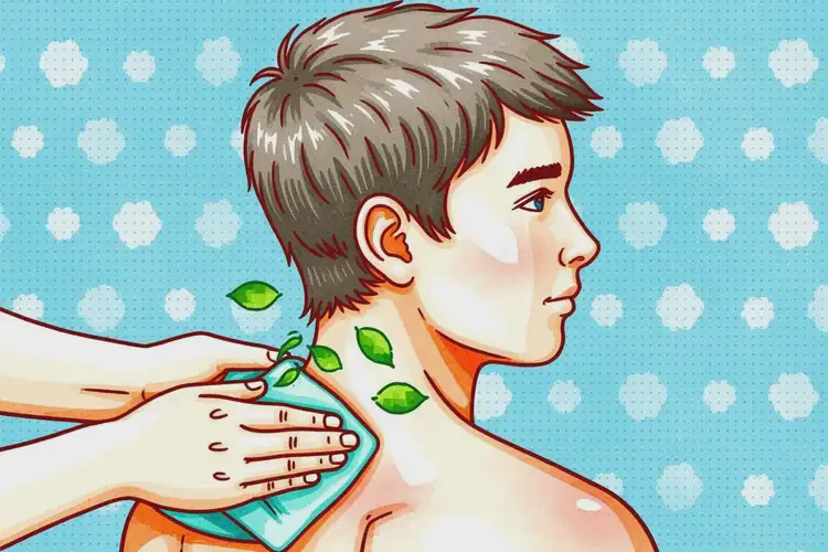 青少年脖子上有濕疹可不可以根治(圖4)