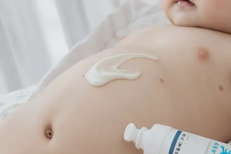 少兒肚子上偶爾起濕疹不管它會自己好嗎(圖3)