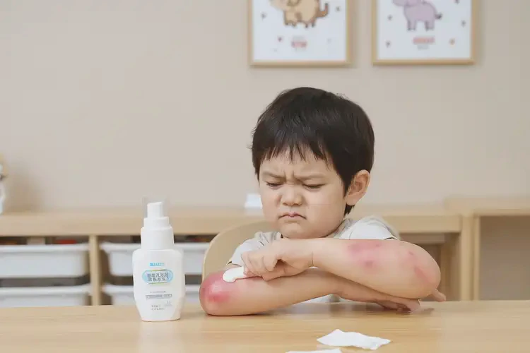 少兒全身起濕疹可不可以徹底自愈(圖2)