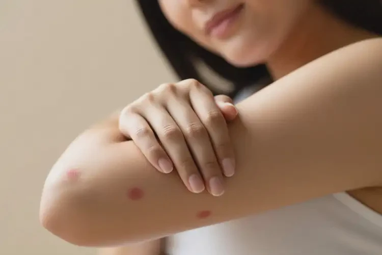 孕婦手臂偶爾起濕疹可以治好嗎(圖4)