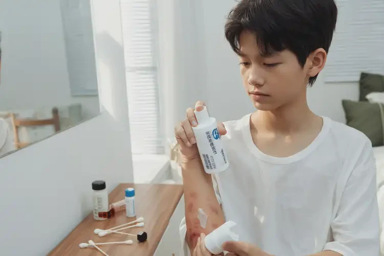 青少年身上偶爾起濕疹可不可以根治(圖4)