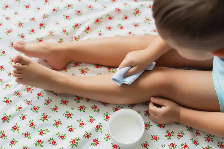 兒童大腿上容易起濕疹可不可以根治(圖3)