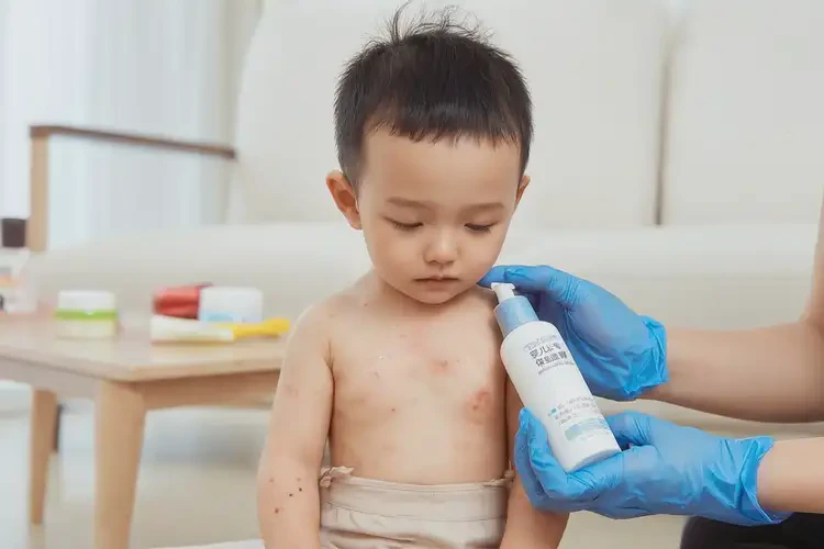幼兒脖子上經(jīng)常長(zhǎng)濕疹可不可以根治(圖2)