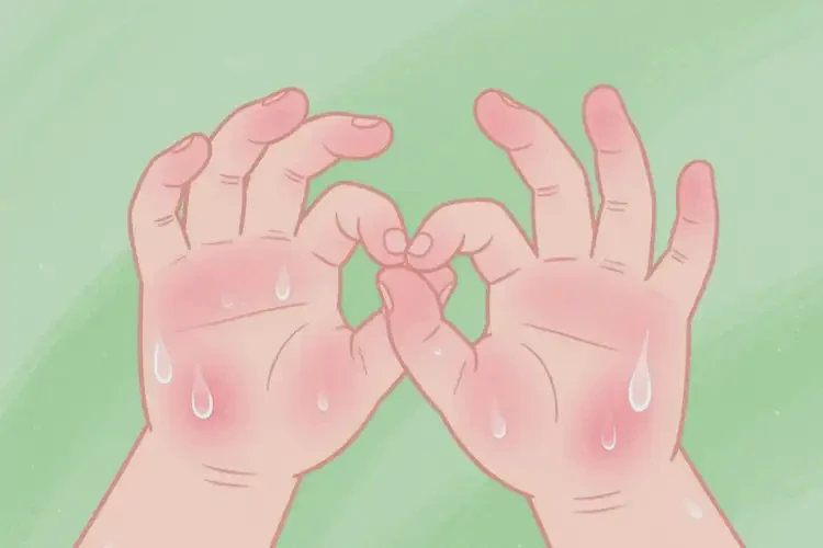 少兒手上經(jīng)常起濕疹可以治好嗎(圖1)