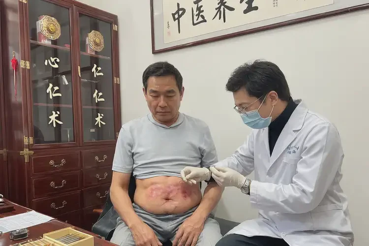 男性肚子上起湿疹可以治好吗(图2)