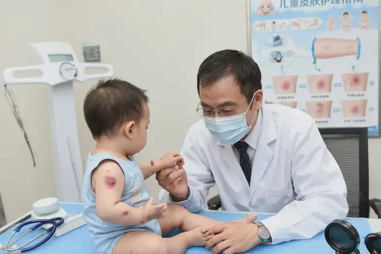 宝宝脖子出现湿疹可以彻底自愈吗(图2)