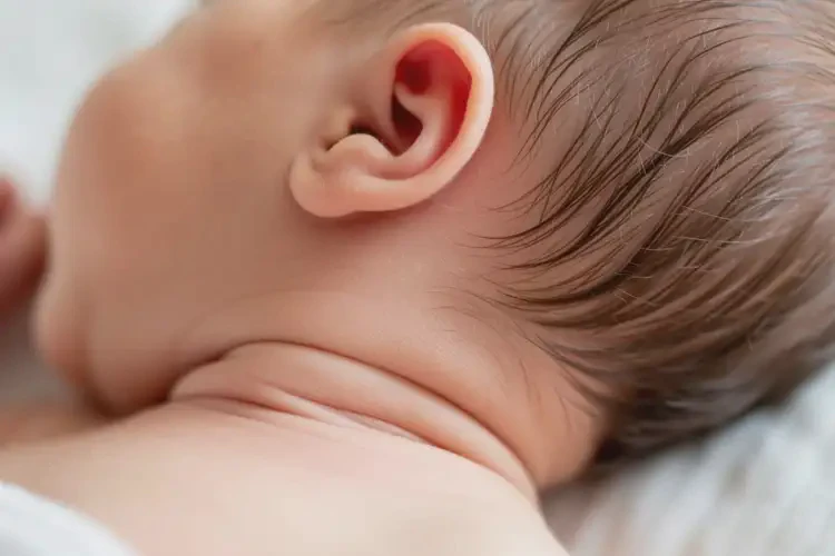 新生兒脖子上經(jīng)常起濕疹可不可以根治(圖3)