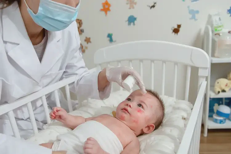 寶寶四肢容易長(zhǎng)濕疹可以治好嗎(圖2)