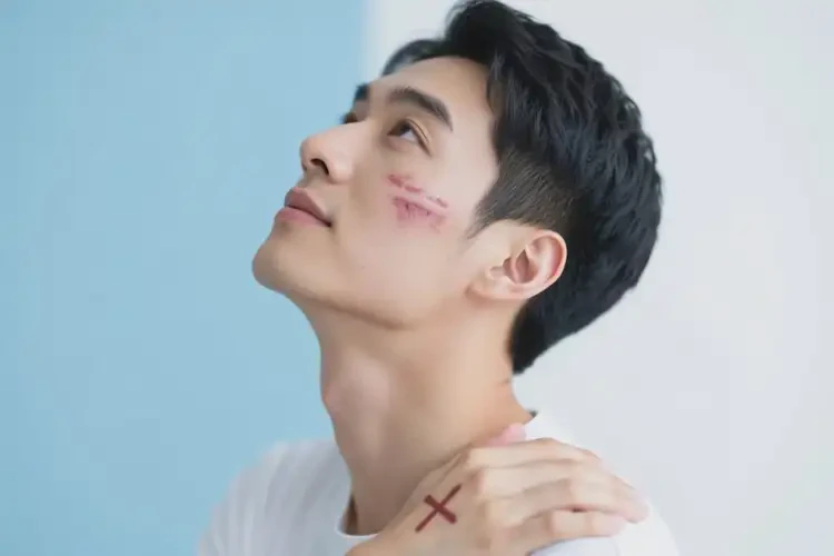 男性面部有濕疹可以治好嗎(圖1)