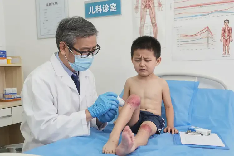 兒童小腿出濕疹可以治好嗎(圖4)