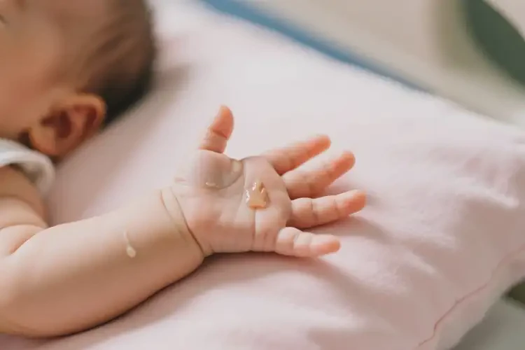 宝宝手上偶尔长湿疹可以治好吗(图2)