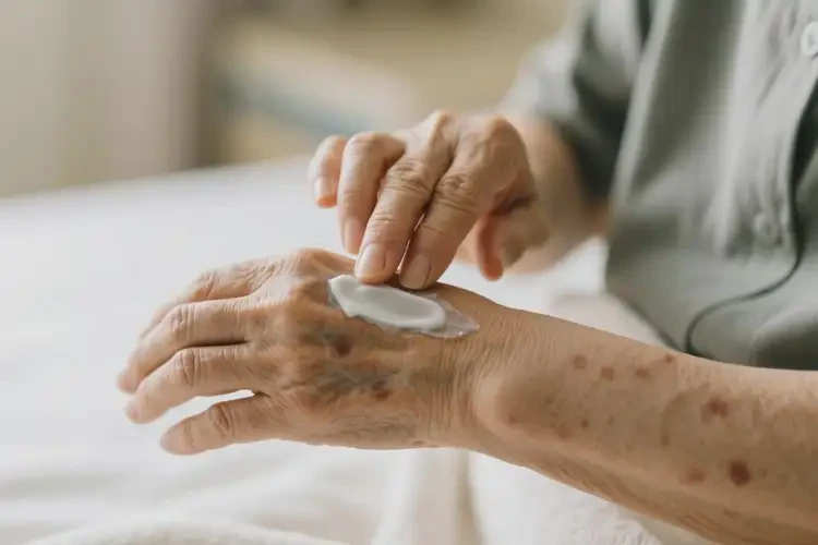 老年人手臂容易起湿疹可不可以根治(图4)