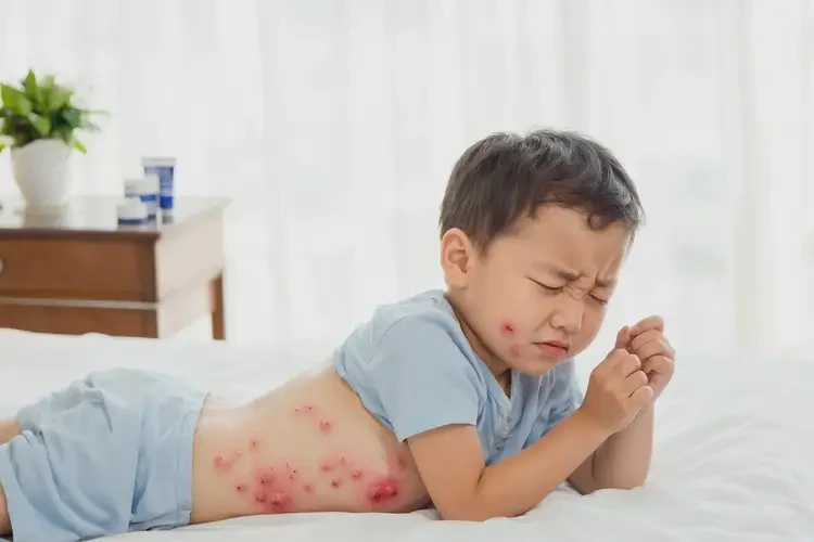 兒童肚子經(jīng)常起濕疹可以治好嗎(圖4)