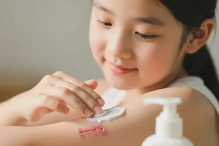 女生手臂上容易起濕疹可不可以根治(圖3)