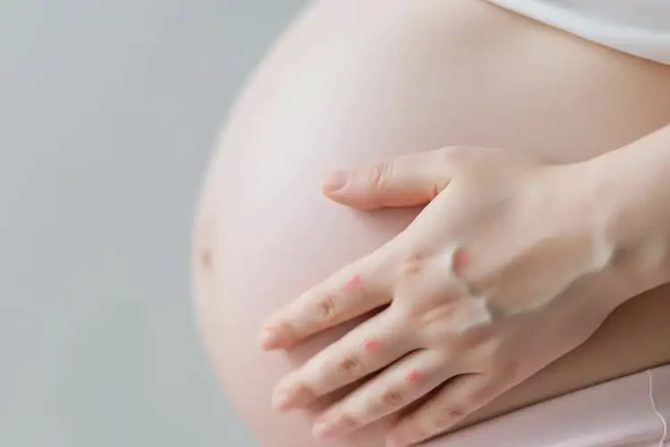 產(chǎn)婦身上起濕疹可不可以根治(圖2)