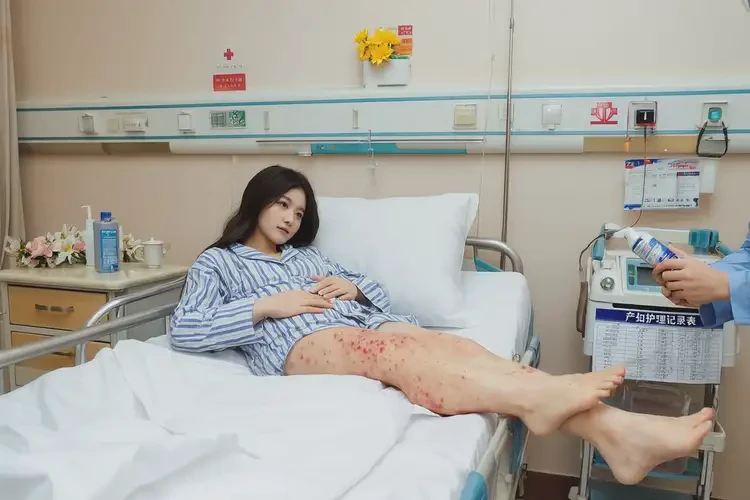 產(chǎn)婦小腿長濕疹可不可以根治(圖1)