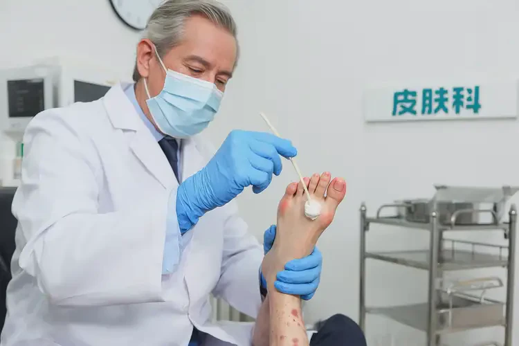 女生腳上經(jīng)常起濕疹可不可以根治(圖3)