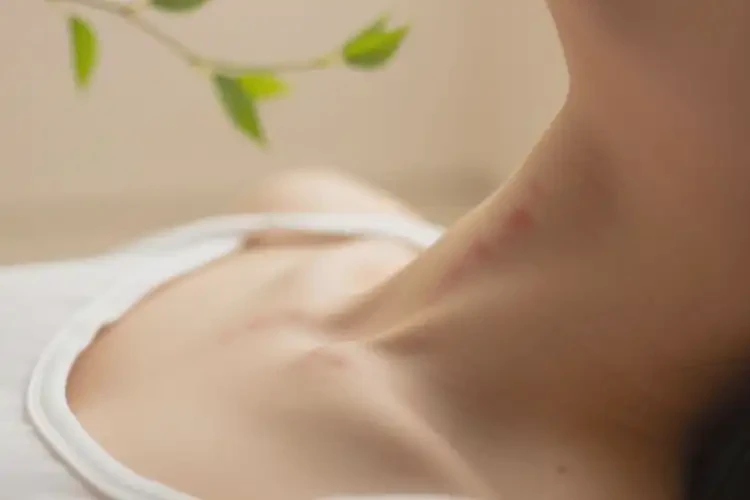 產(chǎn)婦脖子上容易長濕疹可不可以根治(圖4)