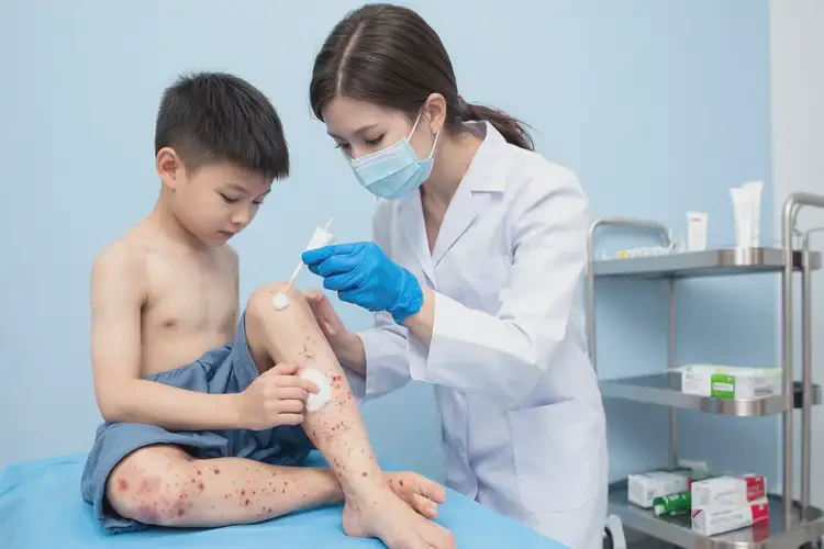 幼兒小腿上出現(xiàn)濕疹可不可以根治(圖3)