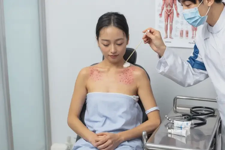 女性全身出濕疹可以治好嗎(圖3)