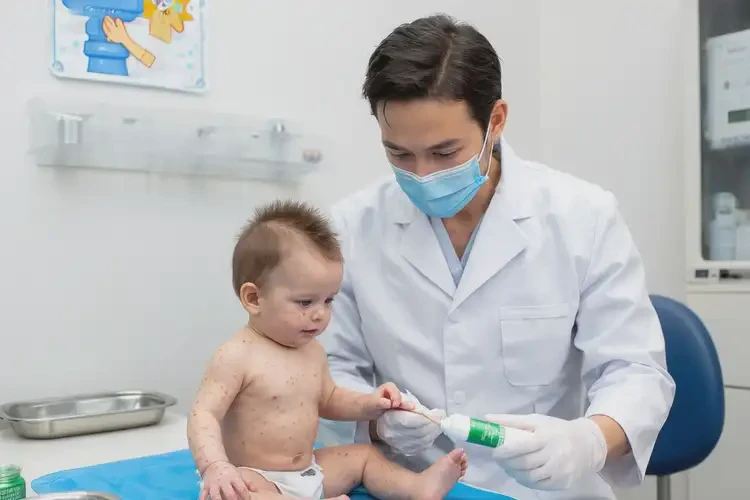 寶寶手上出濕疹可以治好嗎(圖3)