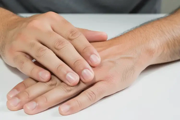 男性手上出現(xiàn)濕疹可以治好嗎(圖1)