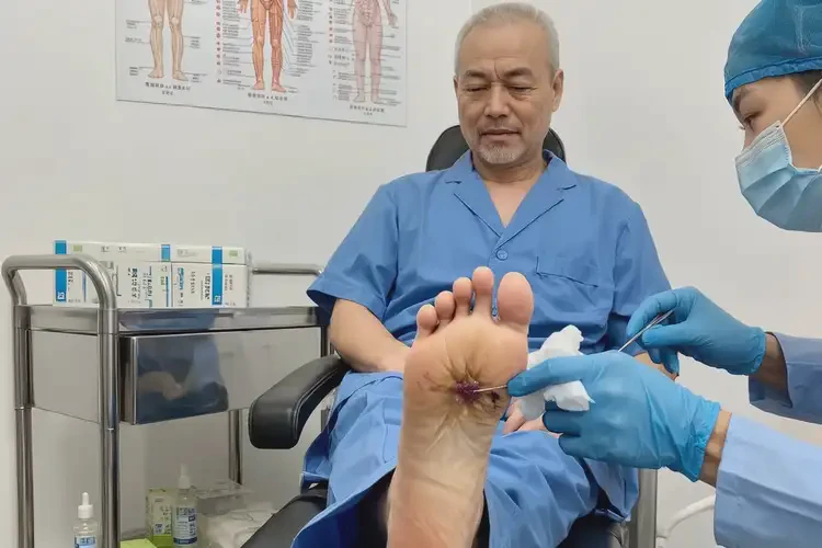 男性腳上出現(xiàn)濕疹可以治好嗎(圖2)