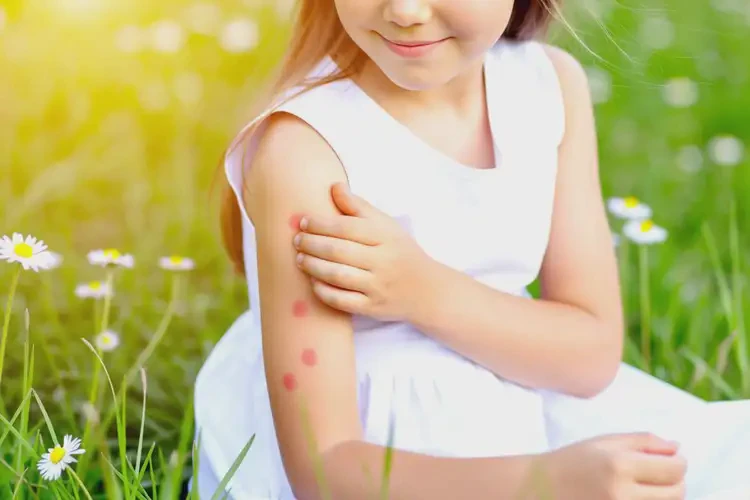 孩子手臂偶爾長濕疹可以治好嗎(圖4)