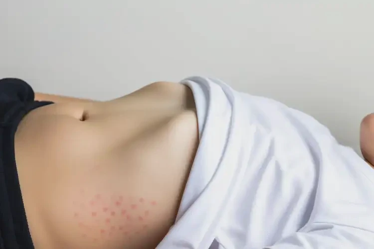 中学生肚子上出湿疹可不可以根治(图4)