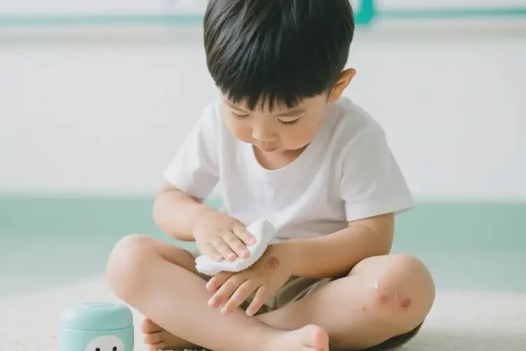 兒童手上偶爾起濕疹可以治好嗎(圖2)