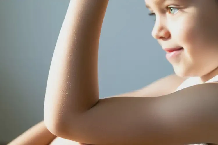 孩子手臂長(zhǎng)濕疹可以治好嗎(圖2)