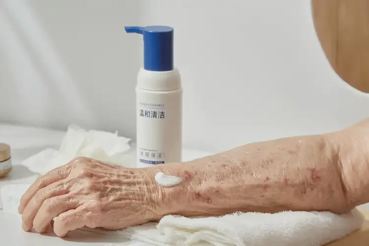 老人手臂經(jīng)常長濕疹可不可以根治(圖3)