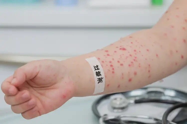 小学生手臂有湿疹可不可以彻底自愈(图4)