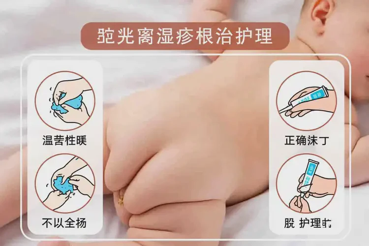 新生兒肛周長(zhǎng)濕疹可不可以根治(圖3)
