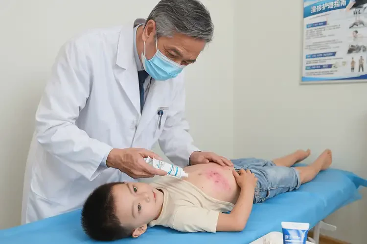 兒童肚子上起濕疹可以治好嗎(圖3)